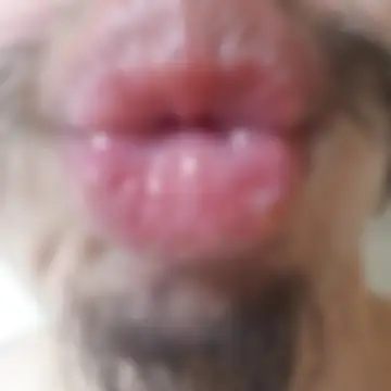 블러 처리된 게시물 이미지